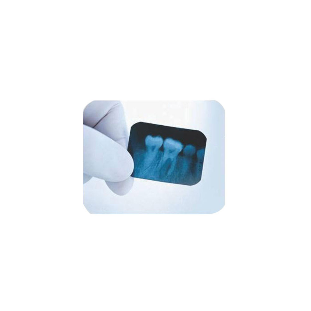 Dental Avenue Xpress SD Self Developing XRay Films