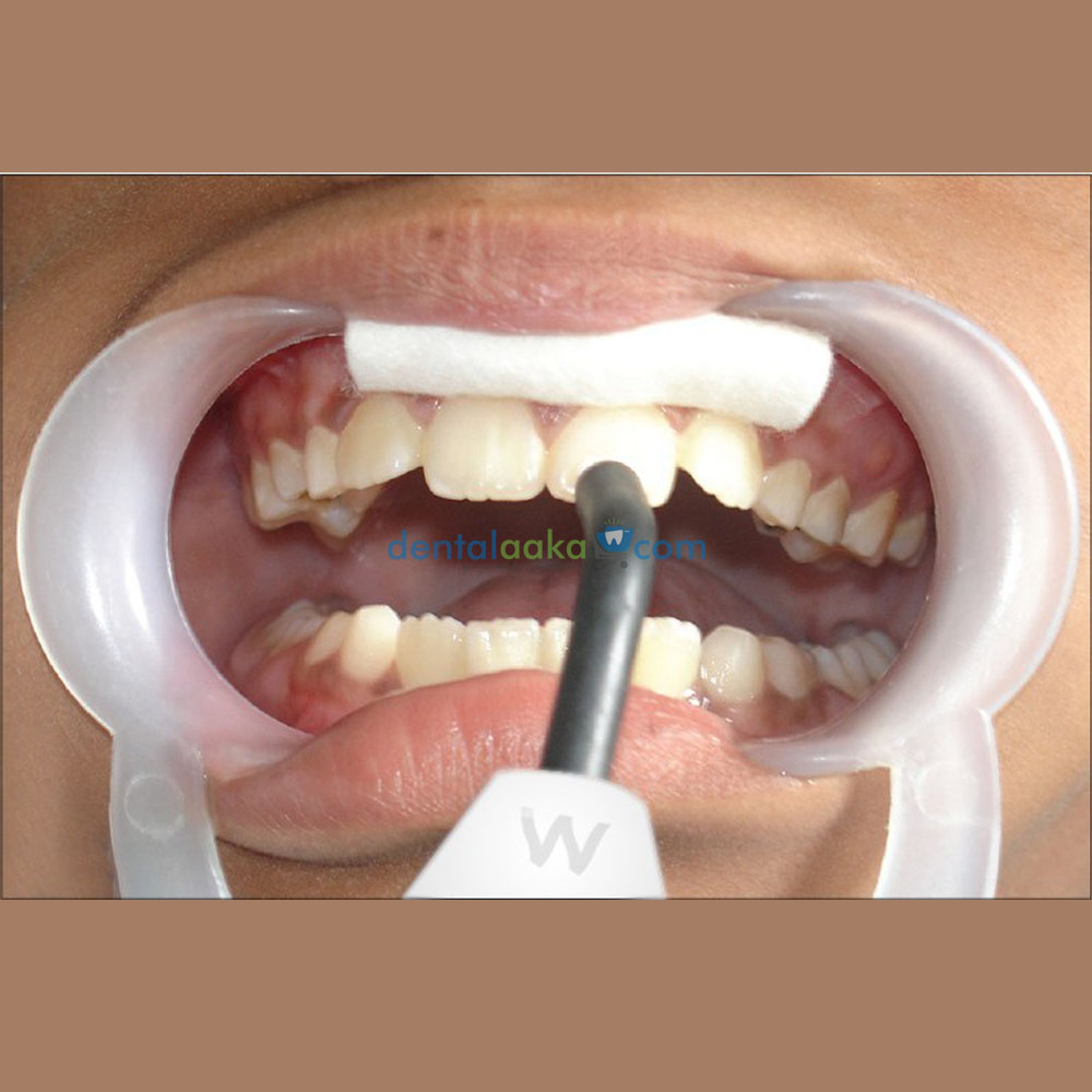 Buy WALDENT ELECTRIC PULP TESTER Online at Best Price