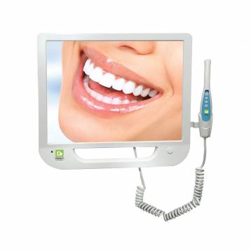 Apple Dental Introral camera