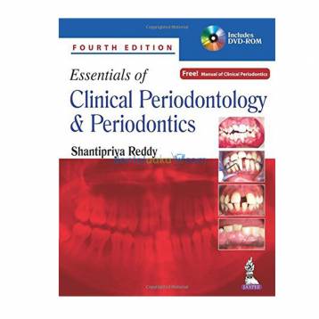 PERIODONTOLOGY BY  SHANTIPRIYA REDDY