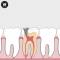 ENDODONTICS